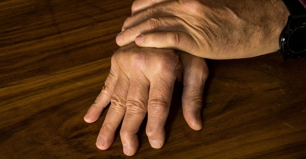 persona-con-artrite-psoriasica