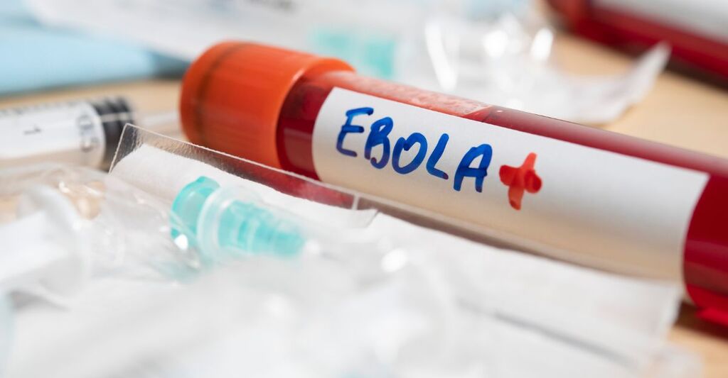 Una provetta di sangue con scritto "Ebola"