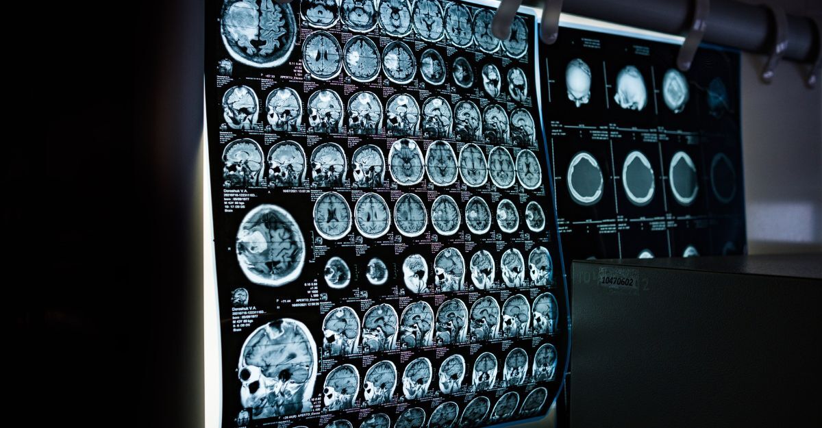 Un'ecografia al cervello