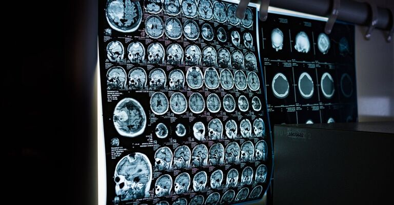 Un'ecografia al cervello