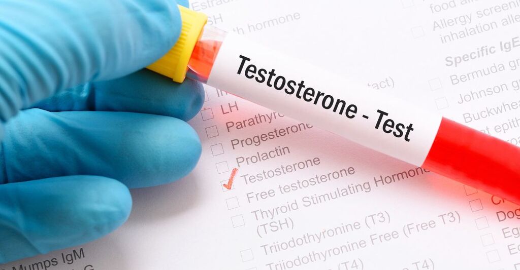 Un medico che tiene in mano una fiala di sangue prelevato per il testo del testosterone