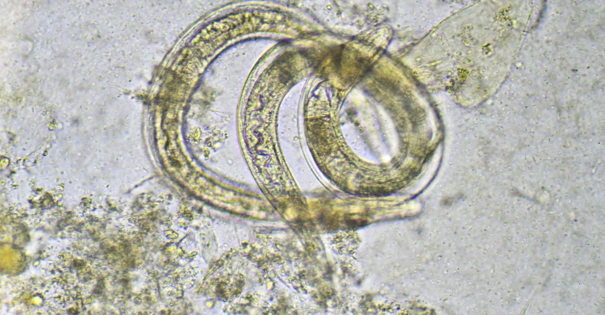 Un parassita al microscopio