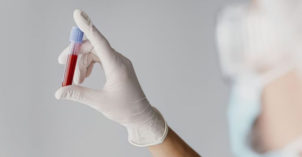 provetta di sangue