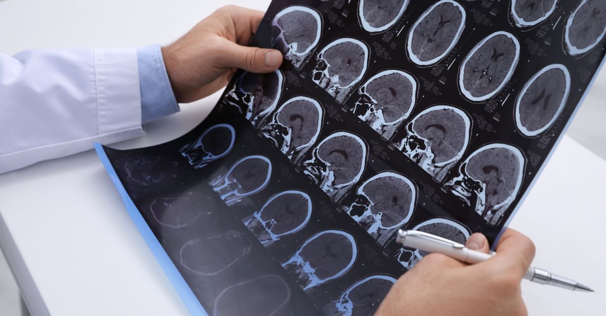 medico tiene in mano risonanza magnetica