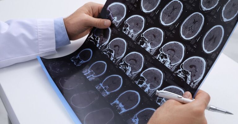 medico tiene in mano risonanza magnetica