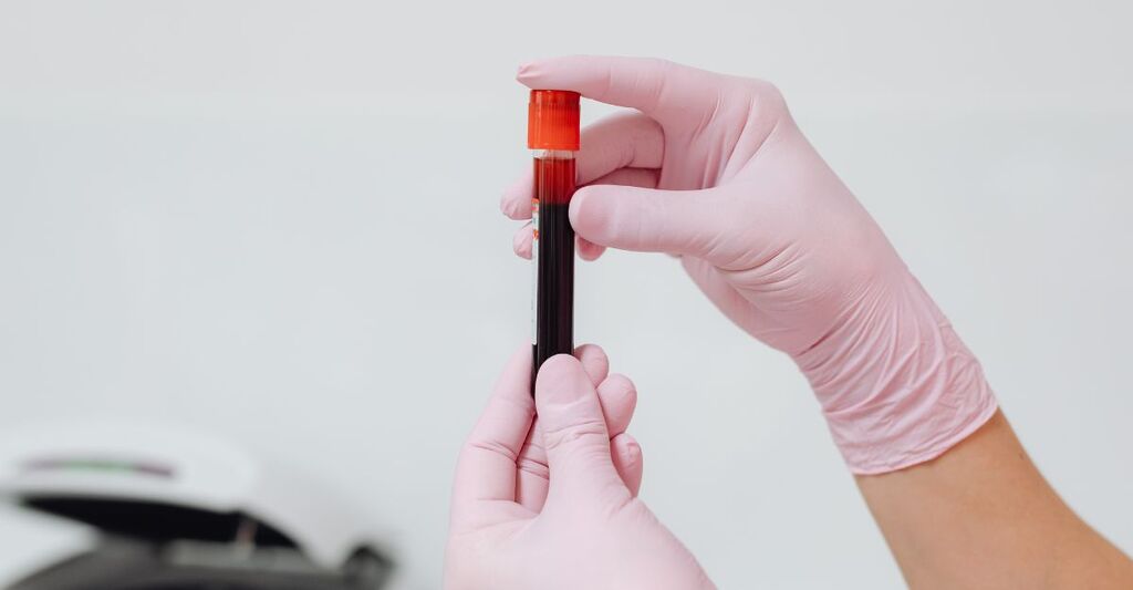 Una fiala di sangue