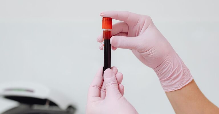Una fiala di sangue