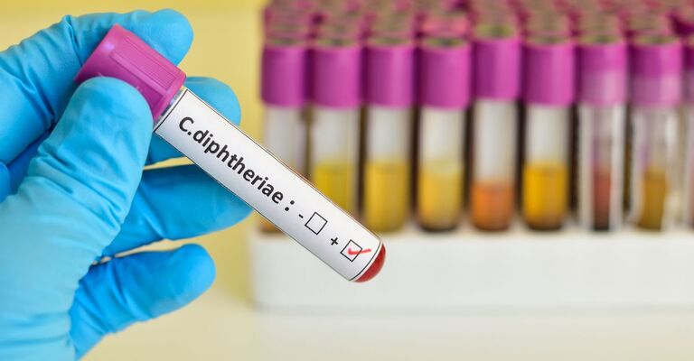 Una fiala di sangue con la scritta "difterite"