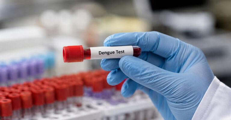 fialetta per dengue test