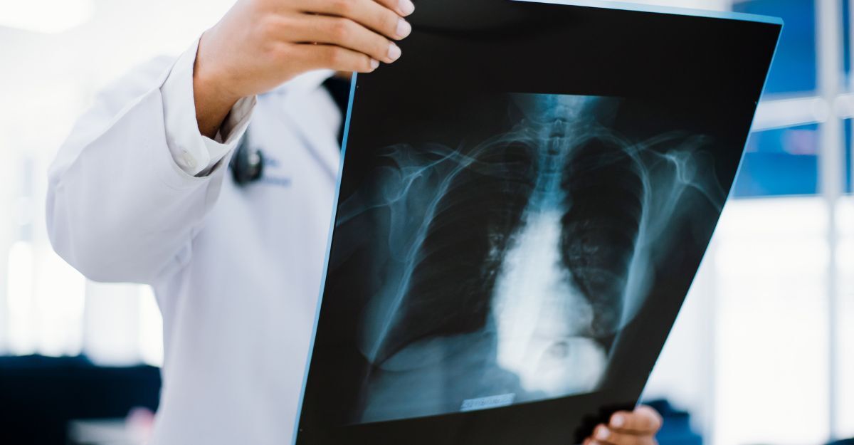 radiografia del fegato tenuta in mano da un medico