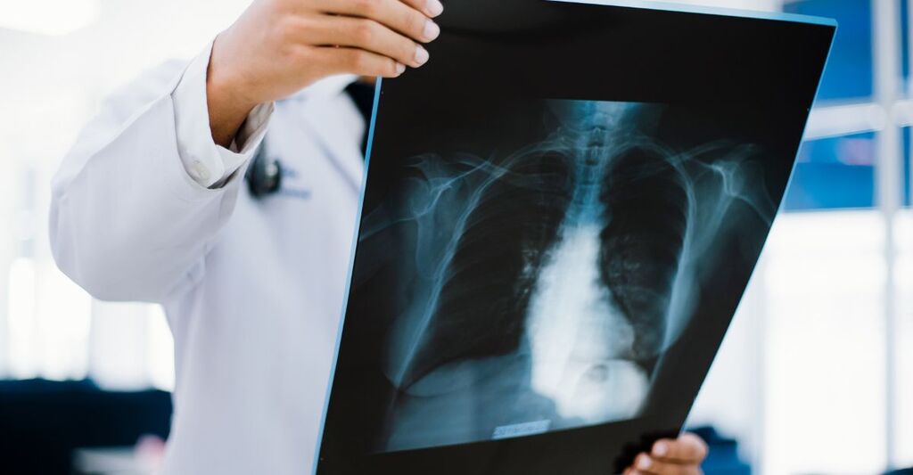 radiografia del fegato tenuta in mano da un medico