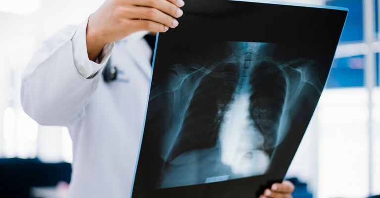radiografia del fegato tenuta in mano da un medico