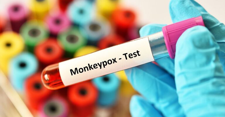Una fiala di sangue con la scritta "monkeypox"