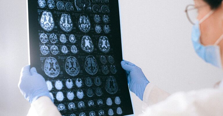 medico controlla rma al cervello