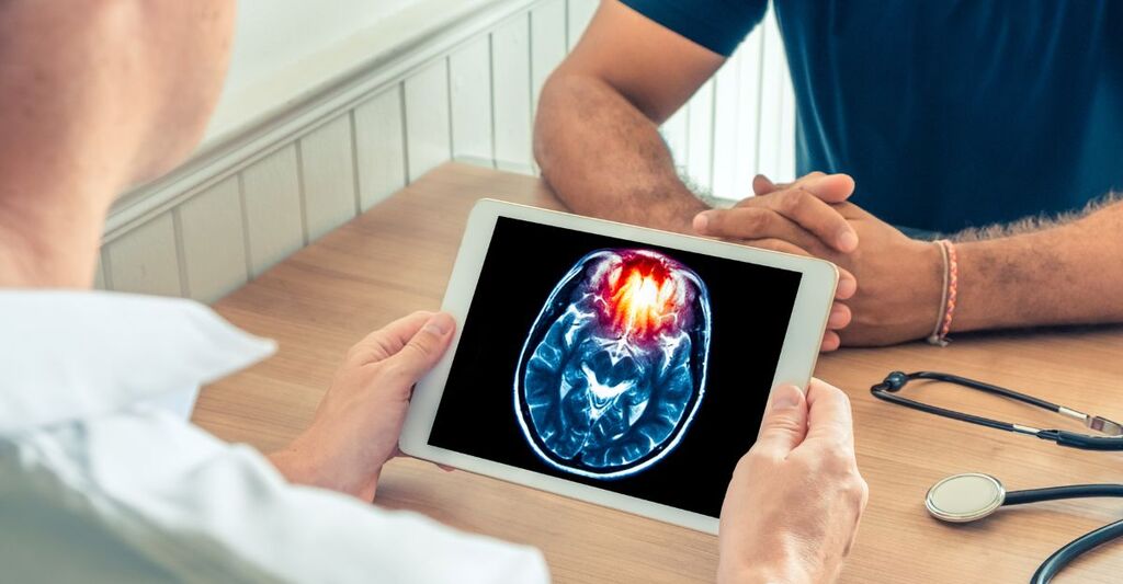 medico mostra rm del cervello