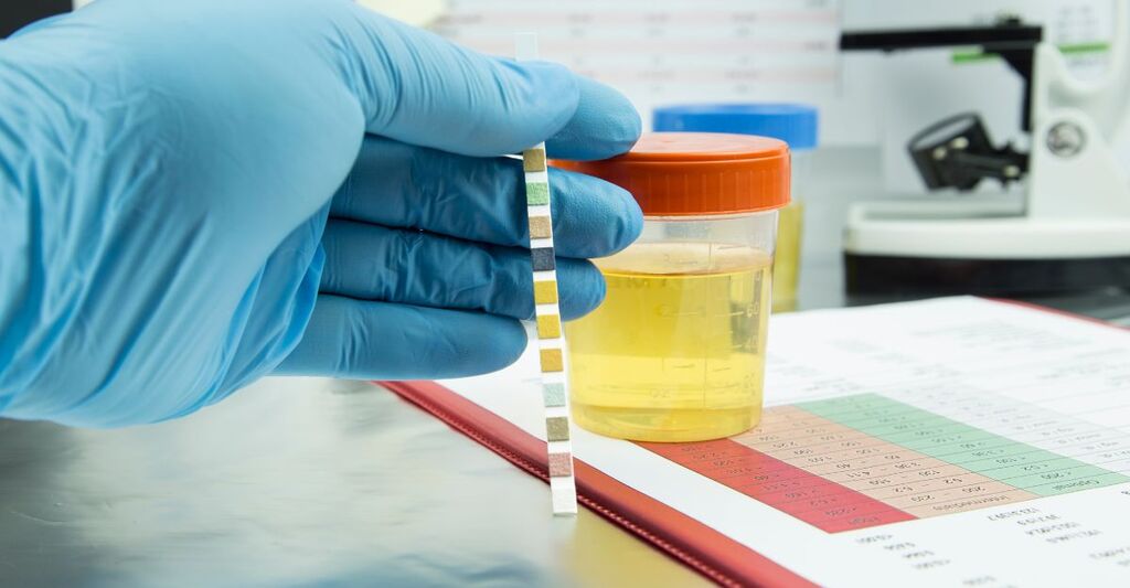 esame delle urine