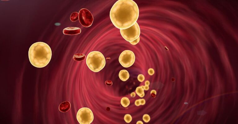 grafica di colesterolo nelle arterie