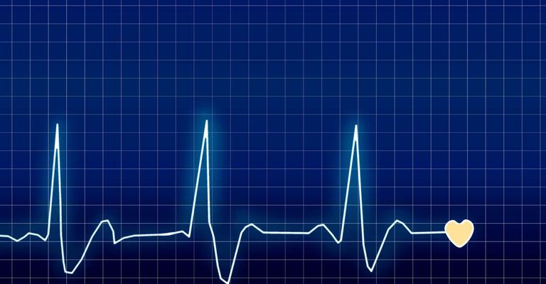 ECG