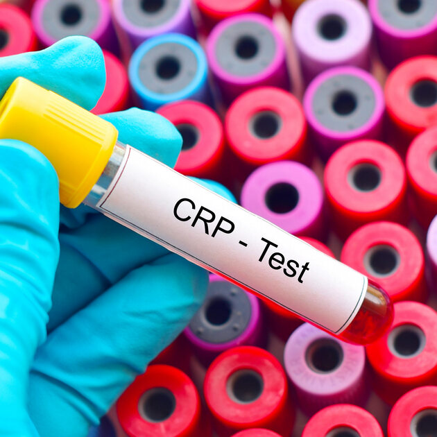 Proteina C Reattiva (PCR) Cos'è, Test,