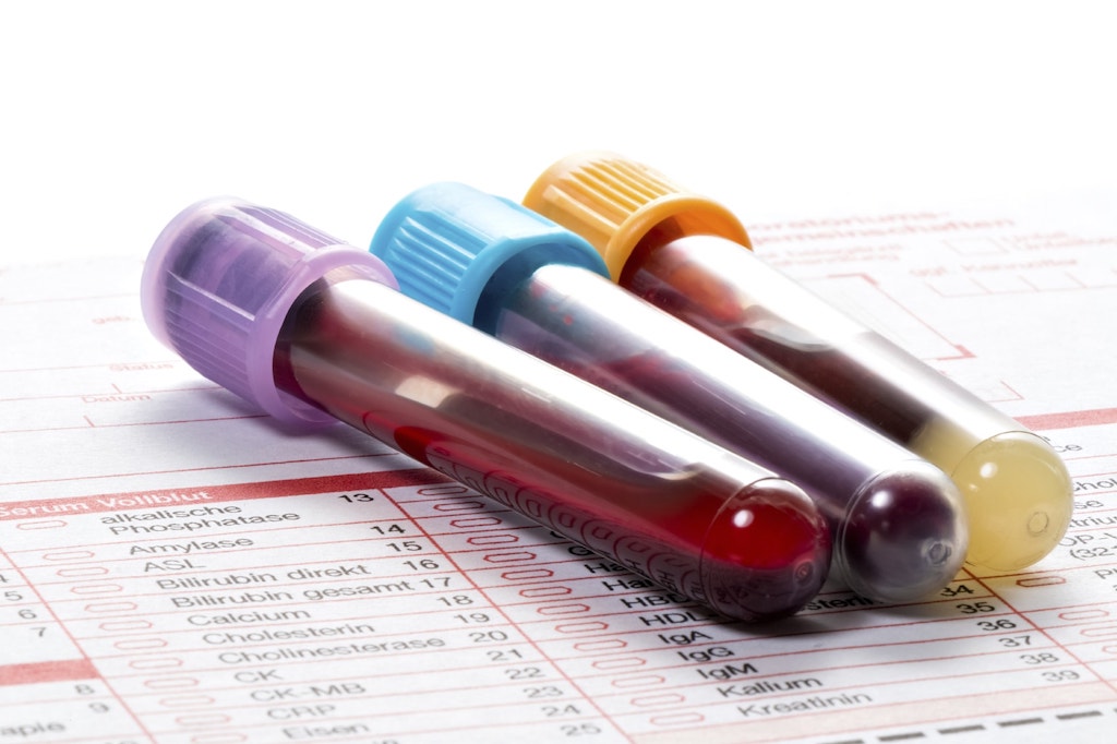 Blood samples for examination.