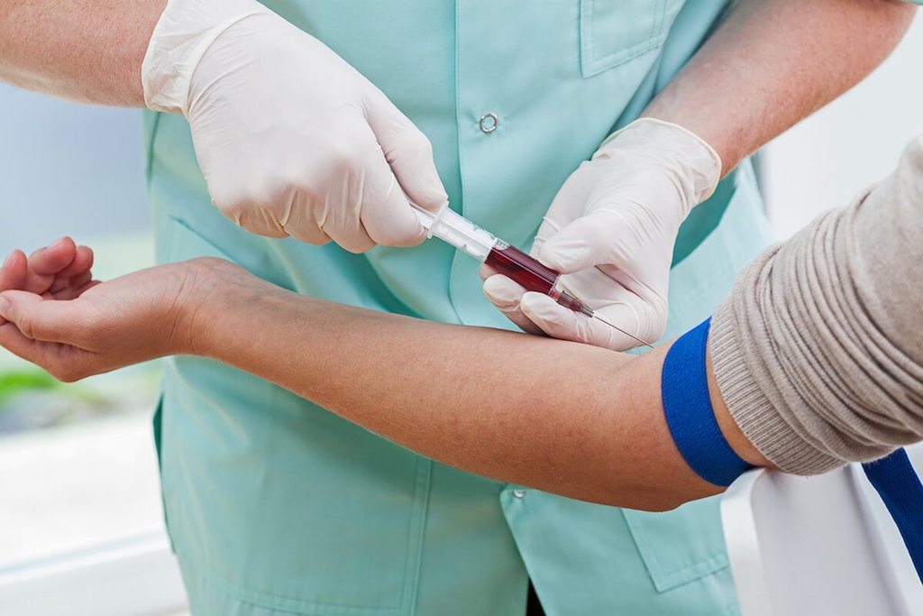 Extracting blood from the inside of the elbow