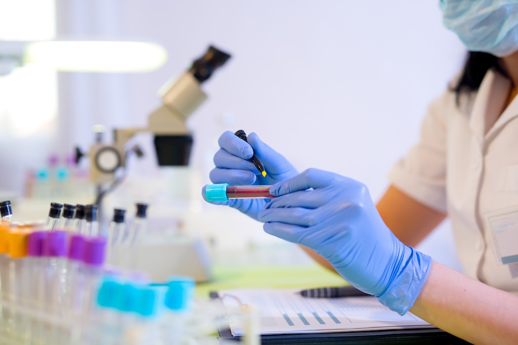 Blood samples examined at the lab.