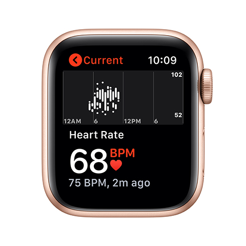 Apple Watch SE GPS 40mm Zlatý hliník *Použitý s DPH – Třída B*