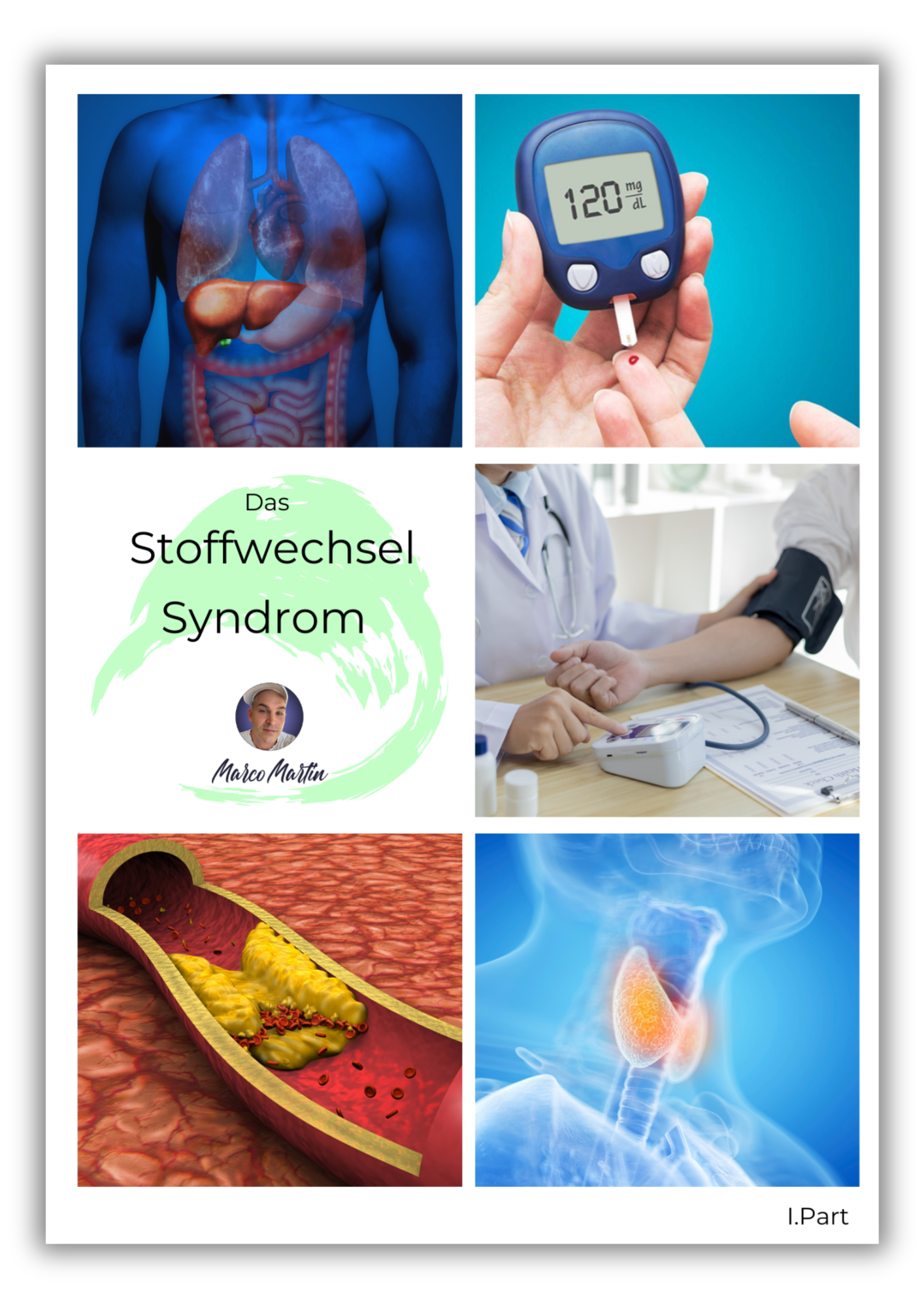 Das Stoffwechsel Syndrom