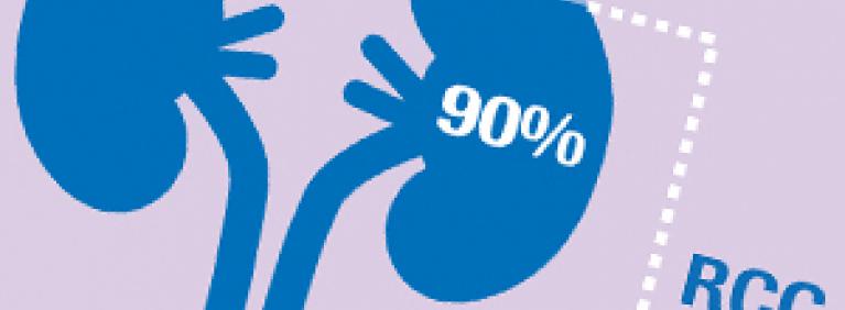 Renal Cell Carcinoma Fact Sheet