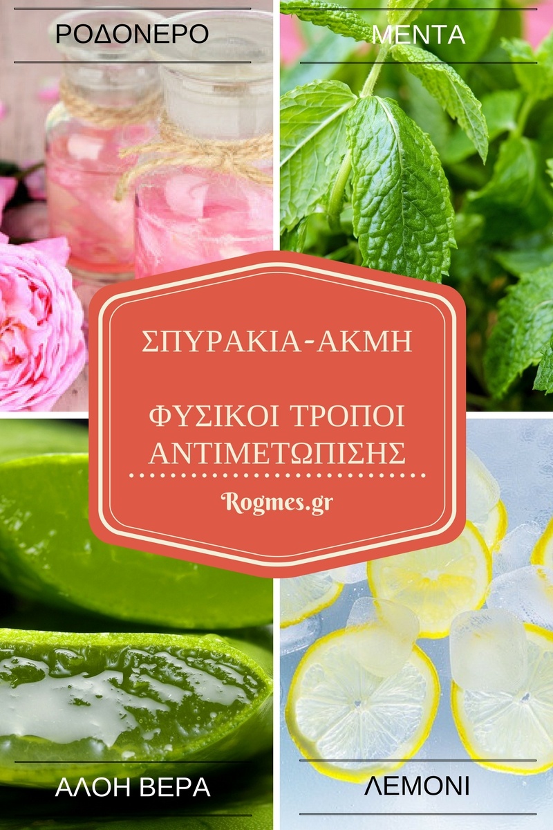 Φυσικές Θεραπείες Για Σπυράκια & Ακμή