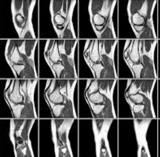 Фото МРТ суставов