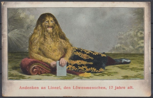 Lionel der Löwenmensch (Stephan Bibrowski), 17 Jahre alt