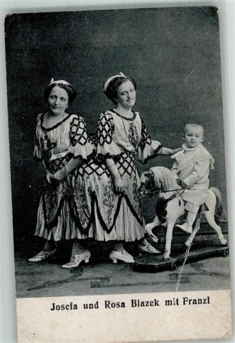 Siamesische Zwillinge Josefa und Rosa Blazek mit Franzl Spielzeug Schaukelpferd