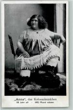 Anna das Kolossalmädchen Zirkus