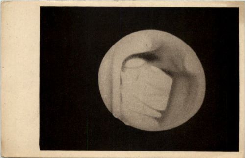 Der Mars
