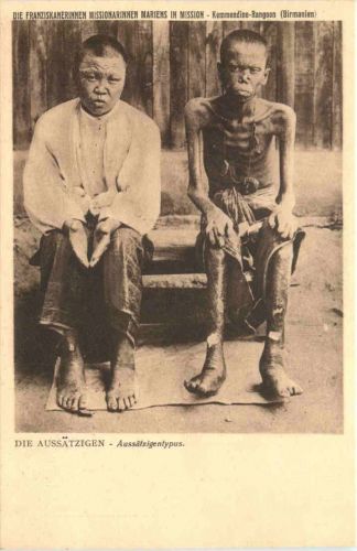 Die Aussätzigen Kemmendine Rangoon - Myanmar