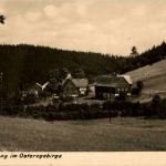 Hirschsprung