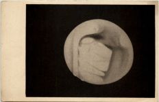 Der Mars