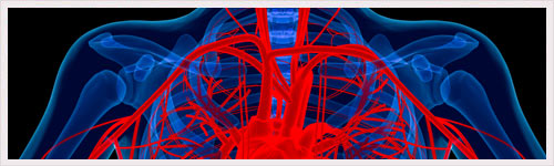 Anévrisme de l’aorte abdominale : identification d’un gène