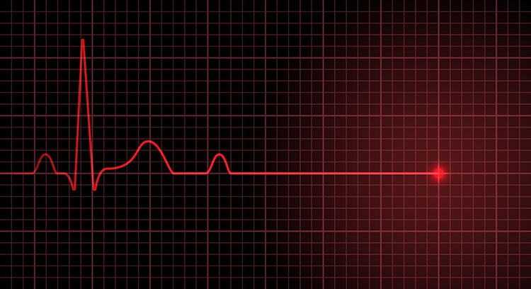 injection de Shenfu dans le traitement de l’arrêt cardiaque