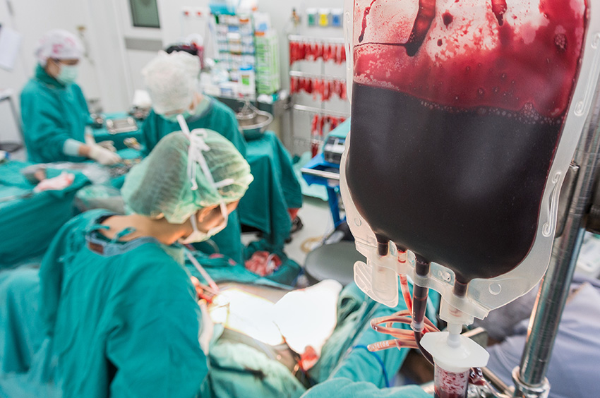 Culots globulaires : une prescription encadrée