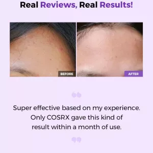 COSRX AHA/BHA Clarifying Treatment Toner 150ml