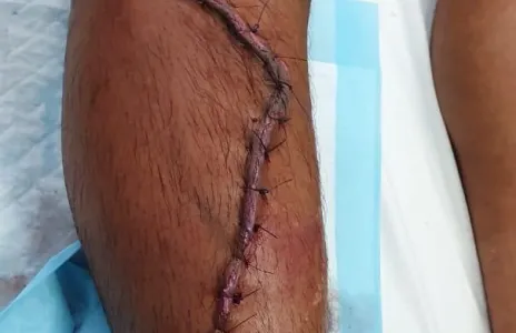 Football Lebanon - خريس ينجو من حادث سير مروع