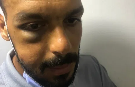 Football Lebanon - تقرير عن إصابات لاعبي العهد