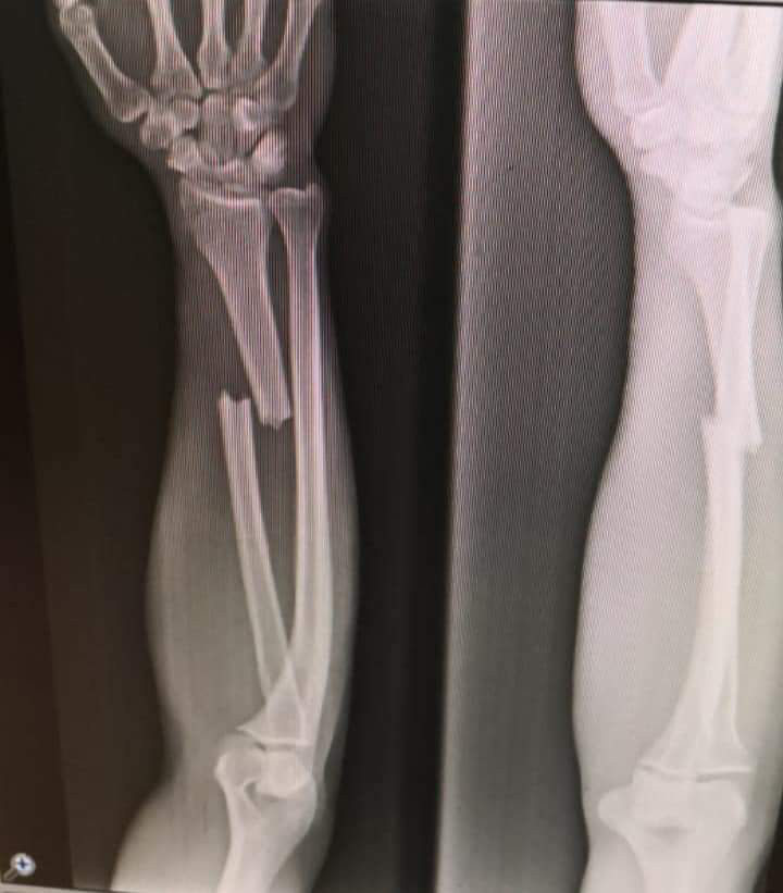 Football Lebanon - صبرا يتعرض للإصابة في معسكر المنتخب الوطني