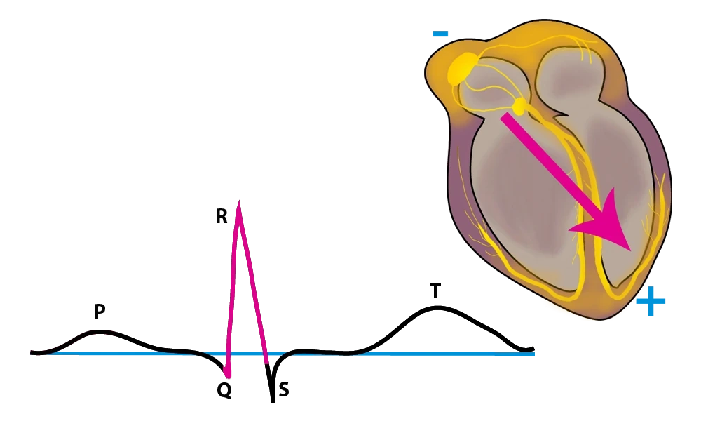EKG, EKG R-Zacke, StudySmarter