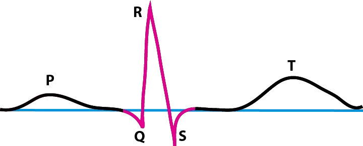 EKG, QRS-Komplex, StudySmarter