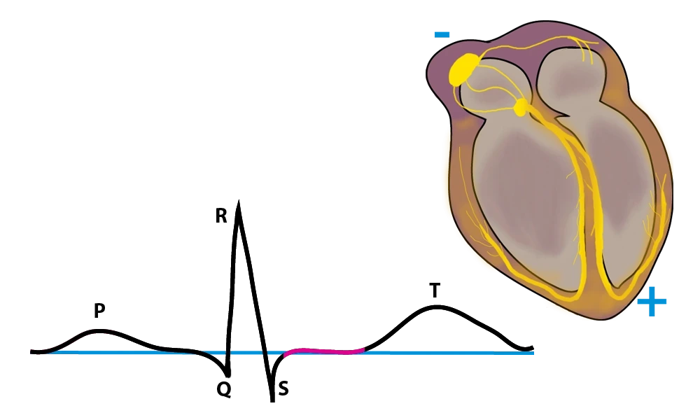 EKG, EKG ST-Strecke, StudySmarter