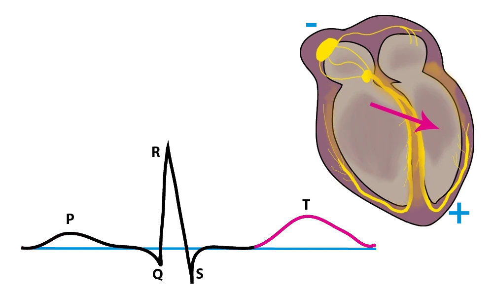 EKG, EKG T-Welle, StudySmarter