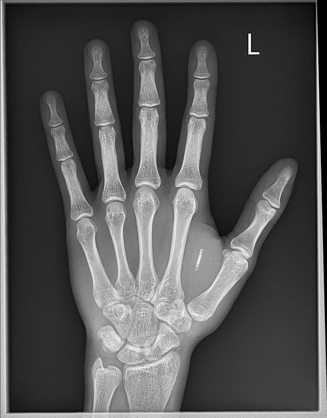 Espectro electromagnético Rayos X StudySmarter